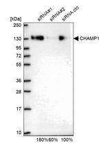 CHAMP1 Antibody in Western Blot (WB)