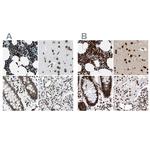 BCLAF1 Antibody in Immunohistochemistry (IHC)