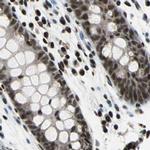 BCLAF1 Antibody in Immunohistochemistry (IHC)