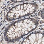 PITRM1 Antibody in Immunohistochemistry (IHC)