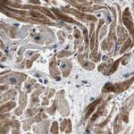 PITRM1 Antibody in Immunohistochemistry (IHC)