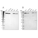 PITRM1 Antibody in Western Blot (WB)