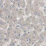 ZHX2 Antibody in Immunohistochemistry (IHC)