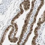 RDBP Antibody in Immunohistochemistry (IHC)