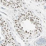 RDBP Antibody in Immunohistochemistry (IHC)