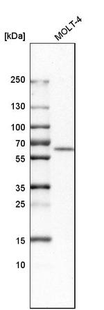 CECR1 Antibody in Western Blot (WB)