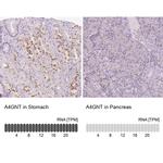 A4GNT Antibody in Immunohistochemistry (IHC)