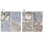 UNC84A Antibody in Immunohistochemistry (IHC)