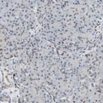 UNC84A Antibody in Immunohistochemistry (IHC)