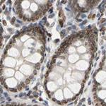 UNC84A Antibody in Immunohistochemistry (IHC)