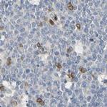 UNC84A Antibody in Immunohistochemistry (IHC)