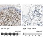 UNC84A Antibody