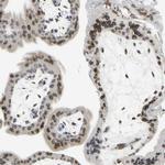 UNC84A Antibody in Immunohistochemistry (IHC)