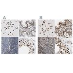 FAM98B Antibody in Immunohistochemistry (IHC)