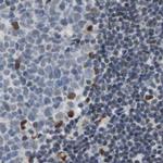 FAM98B Antibody in Immunohistochemistry (IHC)