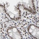 FAM98B Antibody in Immunohistochemistry (IHC)