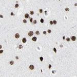 FAM98B Antibody in Immunohistochemistry (IHC)