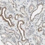 Nope Antibody in Immunohistochemistry (IHC)