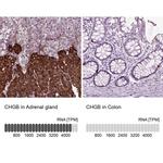 Chromogranin B Antibody in Immunohistochemistry (IHC)