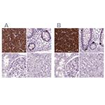 Chromogranin B Antibody in Immunohistochemistry (IHC)