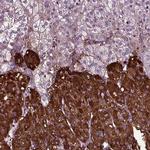 Chromogranin B Antibody in Immunohistochemistry (IHC)