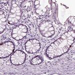 Chromogranin B Antibody in Immunohistochemistry (IHC)