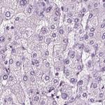 Chromogranin B Antibody in Immunohistochemistry (IHC)