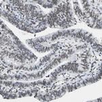 NFIA Antibody in Immunohistochemistry (IHC)