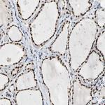 NFIA Antibody in Immunohistochemistry (IHC)