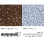 ATP1B2 Antibody in Immunohistochemistry (IHC)