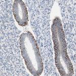 AGPAT5 Antibody in Immunohistochemistry (Paraffin) (IHC (P))