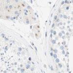 MANEA Antibody in Immunohistochemistry (IHC)