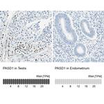PASD1 Antibody in Immunohistochemistry (IHC)
