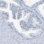 KIAA1024 Antibody in Immunohistochemistry (Paraffin) (IHC (P))