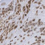 FAM110B Antibody in Immunohistochemistry (IHC)