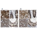 ACBD5 Antibody in Immunohistochemistry (IHC)