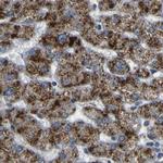 ACBD5 Antibody in Immunohistochemistry (IHC)