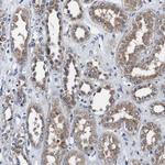 Alix Antibody in Immunohistochemistry (Paraffin) (IHC (P))