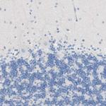 FCGRT Antibody in Immunohistochemistry (IHC)