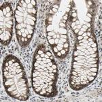 DHRS7B Antibody in Immunohistochemistry (IHC)