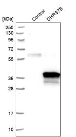 DHRS7B Antibody in Western Blot (WB)