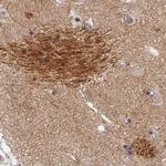 OMG Antibody in Immunohistochemistry (IHC)