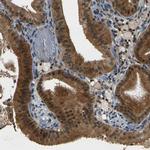 PIGL Antibody in Immunohistochemistry (IHC)