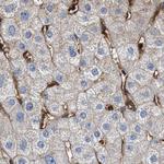 HIP1 Antibody in Immunohistochemistry (Paraffin) (IHC (P))