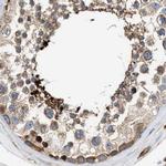 HIP1 Antibody in Immunohistochemistry (Paraffin) (IHC (P))