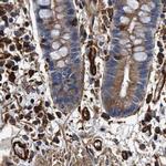 HIP1 Antibody in Immunohistochemistry (IHC)