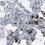 HSPA12B Antibody in Immunohistochemistry (IHC)