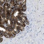 SLCO2A1 Antibody in Immunohistochemistry (IHC)