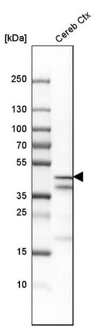 NECAB2 Antibody in Western Blot (WB)