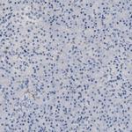 PRRT2 Antibody in Immunohistochemistry (IHC)